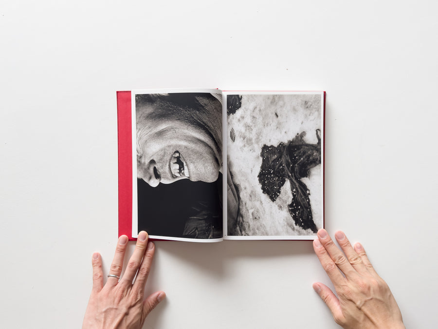 Dark Knees by Mark Cohen